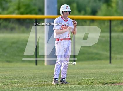 Thumbnail 3 in Madison-Grant @ Anderson photogallery.