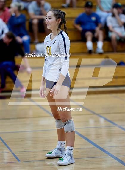 Thumbnail 2 in Oak Ridge @ Granite Bay photogallery.