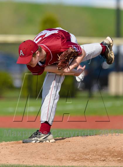 Thumbnail 1 in Antioch @ Vernon Hills photogallery.