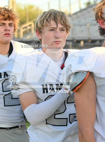 Thumbnail 1 in Centennial vs. Hamilton photogallery.