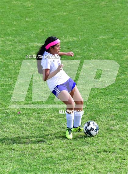 Thumbnail 3 in Brackenridge vs. Burbank photogallery.