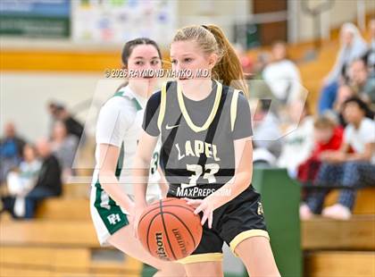 Thumbnail 1 in JV: Lapel @ Pendleton Heights photogallery.