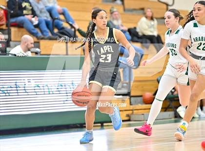 Thumbnail 3 in JV: Lapel @ Pendleton Heights photogallery.