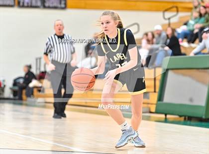 Thumbnail 3 in JV: Lapel @ Pendleton Heights photogallery.