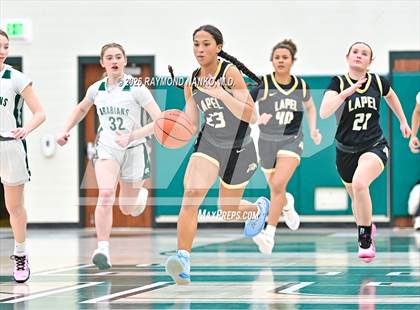 Thumbnail 2 in JV: Lapel @ Pendleton Heights photogallery.