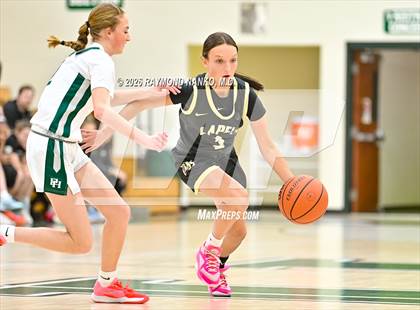 Thumbnail 1 in JV: Lapel @ Pendleton Heights photogallery.