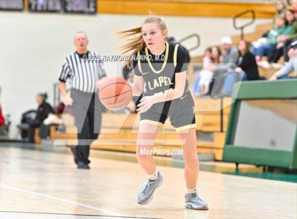 Thumbnail 2 in JV: Lapel @ Pendleton Heights photogallery.