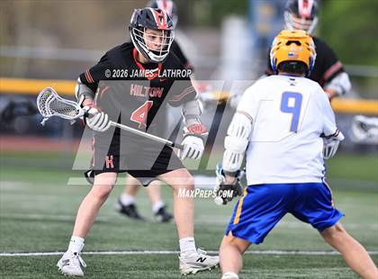 Thumbnail 2 in Hilton @ Irondequoit photogallery.