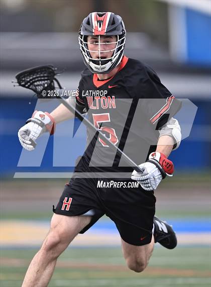 Thumbnail 2 in Hilton @ Irondequoit photogallery.