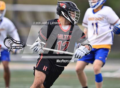 Thumbnail 2 in Hilton @ Irondequoit photogallery.