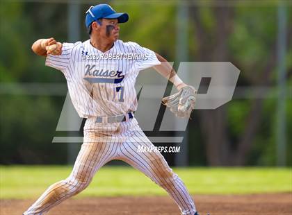 Thumbnail 2 in Kalani @ Kaiser photogallery.