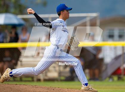 Thumbnail 1 in Kalani @ Kaiser photogallery.