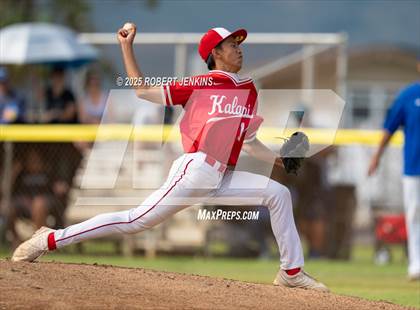 Thumbnail 1 in Kalani @ Kaiser photogallery.