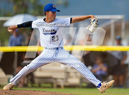 Thumbnail 3 in Kalani @ Kaiser photogallery.