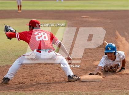 Thumbnail 2 in Kalani @ Kaiser photogallery.