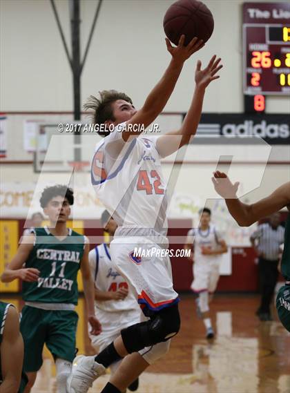 Thumbnail 2 in Kimball vs Central Valley (Stonebarger Tournament) photogallery.
