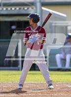 Photo from the gallery "Torres @ Hoover"