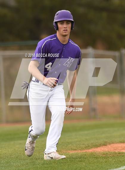 Thumbnail 3 in Weddington vs Ardrey Kell (Charlotte Top 8 Spring Break Tournament) photogallery.