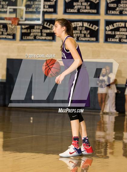 Thumbnail 1 in Arvada West @ Ralston Valley photogallery.