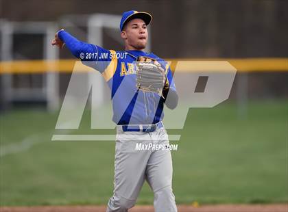 Thumbnail 1 in Ardsley @ Byram Hills photogallery.
