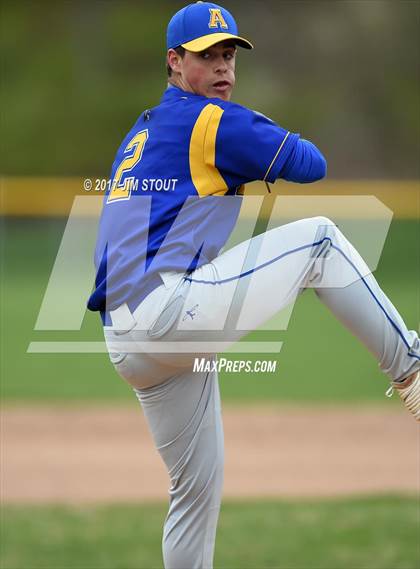 Thumbnail 1 in Ardsley @ Byram Hills photogallery.