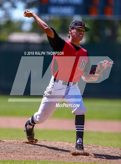 Thumbnail 1 in Big Valley Christian vs. Alpha Charter (CIF SJS D-7 Final Game 1) photogallery.