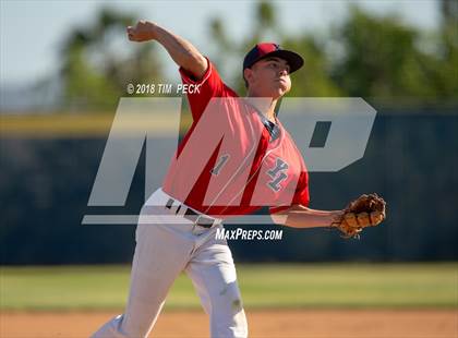 Thumbnail 1 in Foothill @ Yorba Linda photogallery.