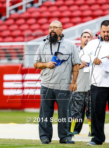 Thumbnail 2 in Wilcox vs. Santa Clara @ Levi's Stadium photogallery.