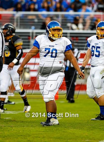 Thumbnail 3 in Wilcox vs. Santa Clara @ Levi's Stadium photogallery.