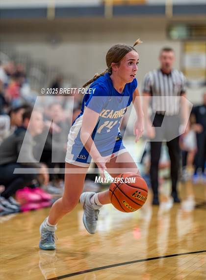 Thumbnail 3 in Kearney @ Lincoln Southeast photogallery.