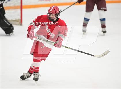 Thumbnail 3 in Conard @ BBD [Brookfield/Bethel/Danbury] photogallery.