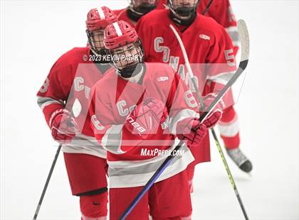 Thumbnail 2 in Conard @ BBD [Brookfield/Bethel/Danbury] photogallery.