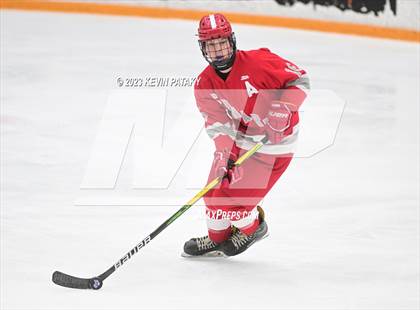 Thumbnail 1 in Conard @ BBD [Brookfield/Bethel/Danbury] photogallery.