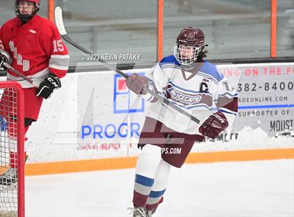 Thumbnail 3 in Conard @ BBD [Brookfield/Bethel/Danbury] photogallery.