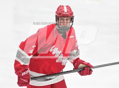 Thumbnail 1 in Conard @ BBD [Brookfield/Bethel/Danbury] photogallery.