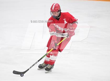 Thumbnail 2 in Conard @ BBD [Brookfield/Bethel/Danbury] photogallery.