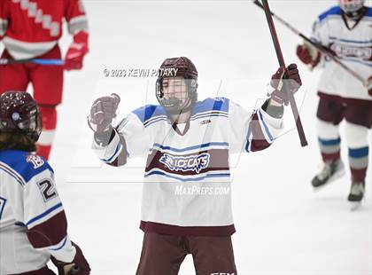 Thumbnail 3 in Conard @ BBD [Brookfield/Bethel/Danbury] photogallery.