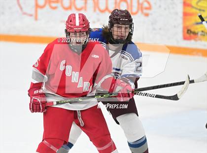 Thumbnail 3 in Conard @ BBD [Brookfield/Bethel/Danbury] photogallery.