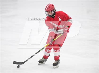 Thumbnail 1 in Conard @ BBD [Brookfield/Bethel/Danbury] photogallery.