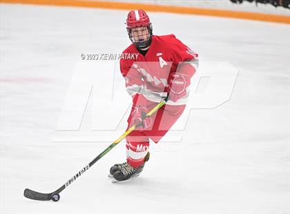 Thumbnail 2 in Conard @ BBD [Brookfield/Bethel/Danbury] photogallery.