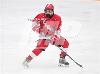 Thumbnail 3 in Conard @ BBD [Brookfield/Bethel/Danbury] photogallery.