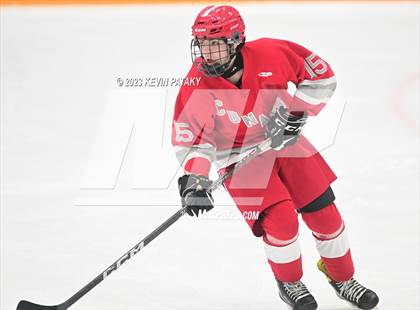 Thumbnail 2 in Conard @ BBD [Brookfield/Bethel/Danbury] photogallery.