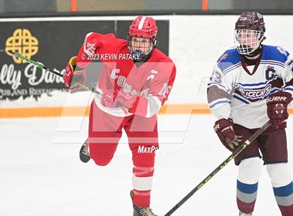 Thumbnail 3 in Conard @ BBD [Brookfield/Bethel/Danbury] photogallery.