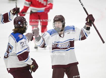 Thumbnail 2 in Conard @ BBD [Brookfield/Bethel/Danbury] photogallery.