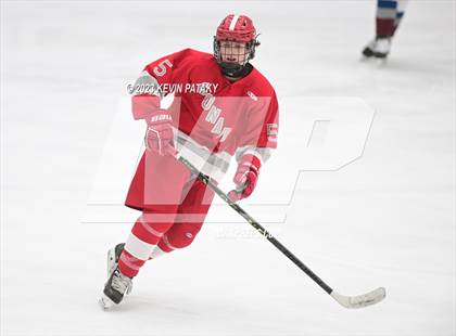 Thumbnail 2 in Conard @ BBD [Brookfield/Bethel/Danbury] photogallery.