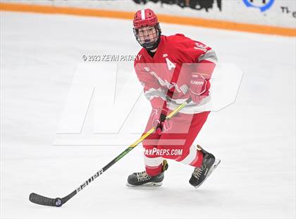 Thumbnail 3 in Conard @ BBD [Brookfield/Bethel/Danbury] photogallery.