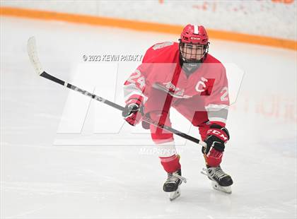 Thumbnail 3 in Conard @ BBD [Brookfield/Bethel/Danbury] photogallery.
