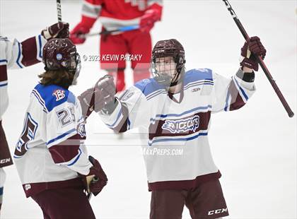 Thumbnail 3 in Conard @ BBD [Brookfield/Bethel/Danbury] photogallery.