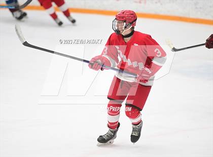 Thumbnail 3 in Conard @ BBD [Brookfield/Bethel/Danbury] photogallery.