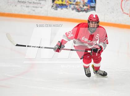 Thumbnail 2 in Conard @ BBD [Brookfield/Bethel/Danbury] photogallery.